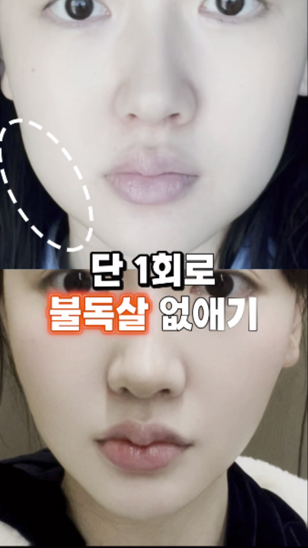 감량 후기 | 하프클리닉 대전 :: 대전 지방분해주사, 비만클리닉, 다이어트, 다이어트약, 다이어트 병원, 하프컷주사, 서울의대 출신